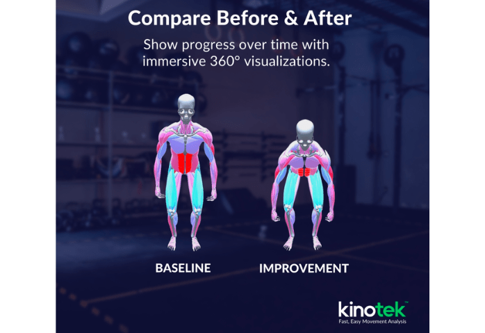 One human standing upright showing before KinoTec Technology and another human showing improvement
